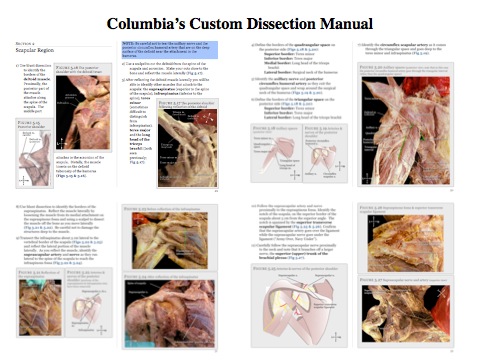 ColumbiaDissector.jpg