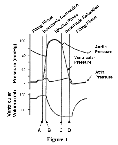 CV Physiology  Ventricular Pressure-Volume Relationship